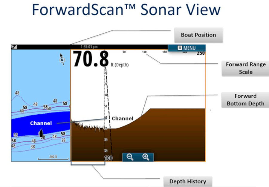 ForwardScan™ Transducer Only
